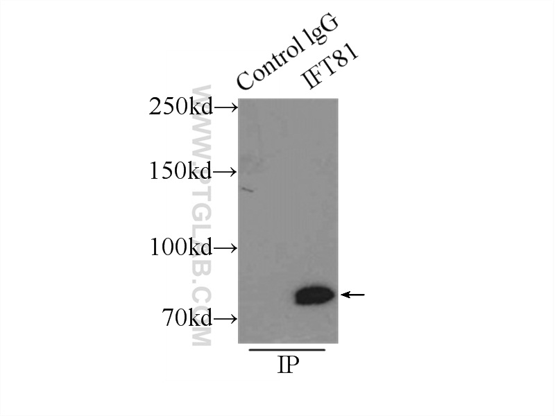 IP experiment of mouse brain using 11744-1-AP