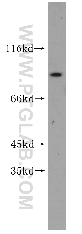 IFT81 Polyclonal antibody