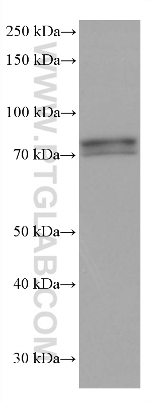 WB analysis of rabbit brain using 67987-1-Ig