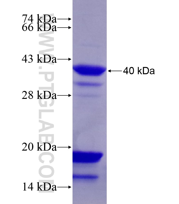 IFT81 fusion protein Ag17781 SDS-PAGE IFT81 fusion protein Ag17781 SDS-PAGE
