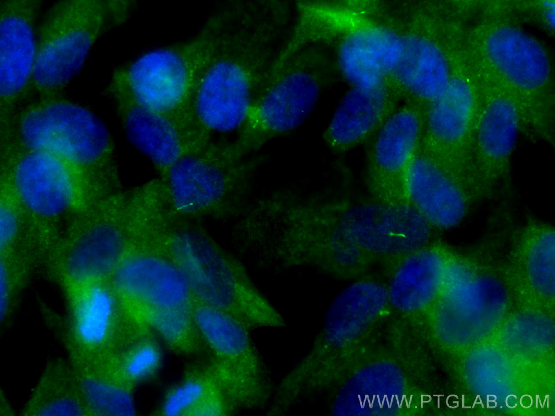 IF Staining of hTERT-RPE1 using 13967-1-AP