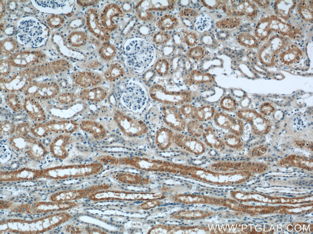 IHC staining of human kidney using 60227-1-Ig (same clone as 60227-1-PBS)