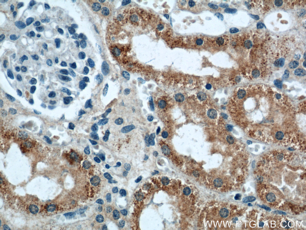 IHC staining of human kidney using 60227-1-Ig (same clone as 60227-1-PBS)
