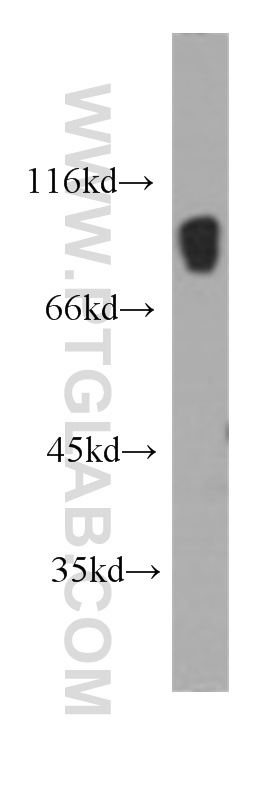 IFT88 Monoclonal antibody