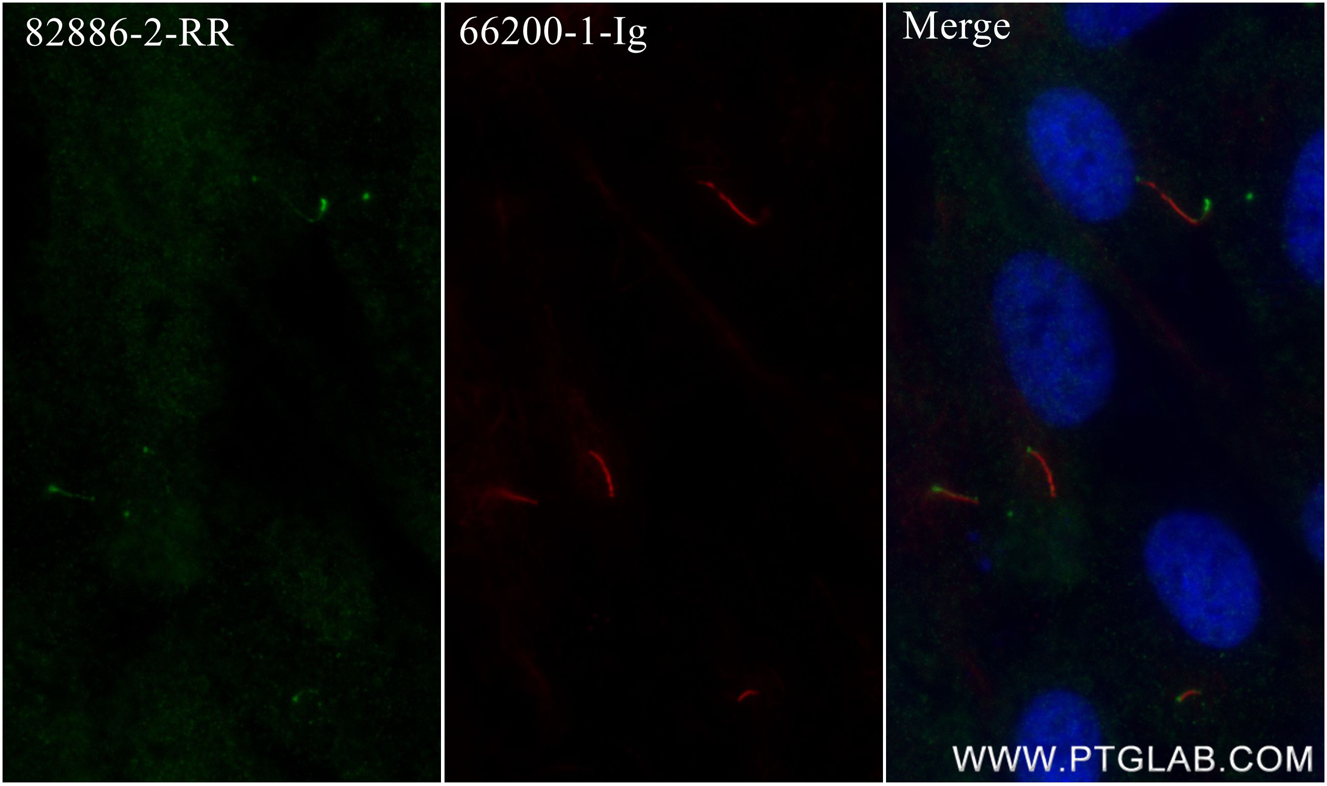 IF Staining of hTERT-RPE1 using 82886-2-RR (same clone as 82886-2-PBS)