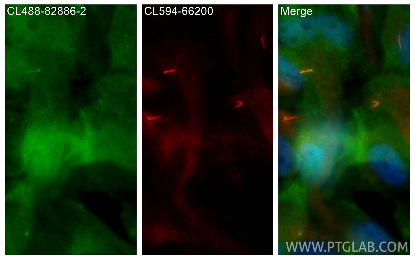 IF Staining of hTERT-RPE1 using CL488-82886-2