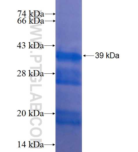 IFT88 fusion protein Ag5152 SDS-PAGE