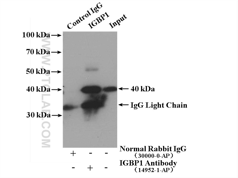 IP experiment of Jurkat using 14952-1-AP