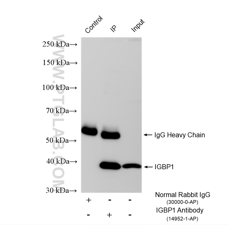 IP experiment of Jurkat using 14952-1-AP IP experiment of Jurkat using 14952-1-AP