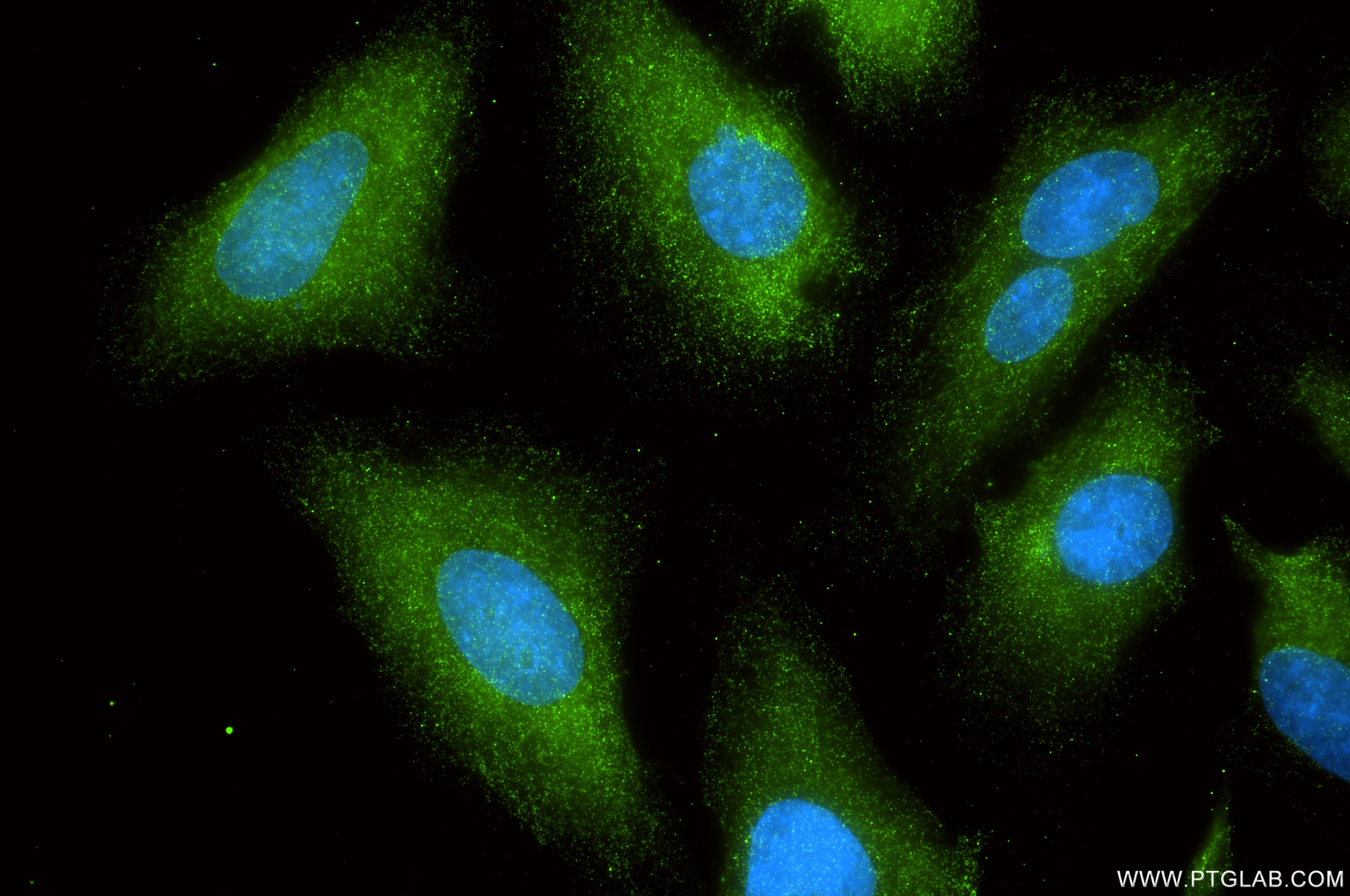 IF Staining of HeLa using 87726-1-RR (same clone as 87726-1-PBS) IF Staining of HeLa using 87726-1-RR (same clone as 87726-1-PBS)