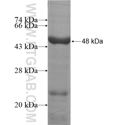 IGDCC3 fusion protein Ag10254 SDS-PAGE IGDCC3 fusion protein Ag10254 SDS-PAGE