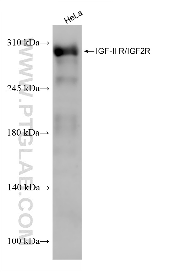 HeLa cells were subjected to SDS PAGE followed by western blot with 86821-1-RR (IGF-II R/IGF2R antibody) at dilution of 1:1000 incubated at room temperature for 1.5 hours. WB analysis of HeLa using 86821-1-RR