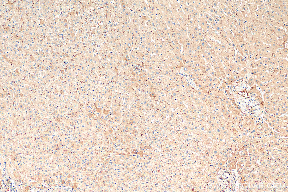 IHC staining of human liver using 28530-1-AP