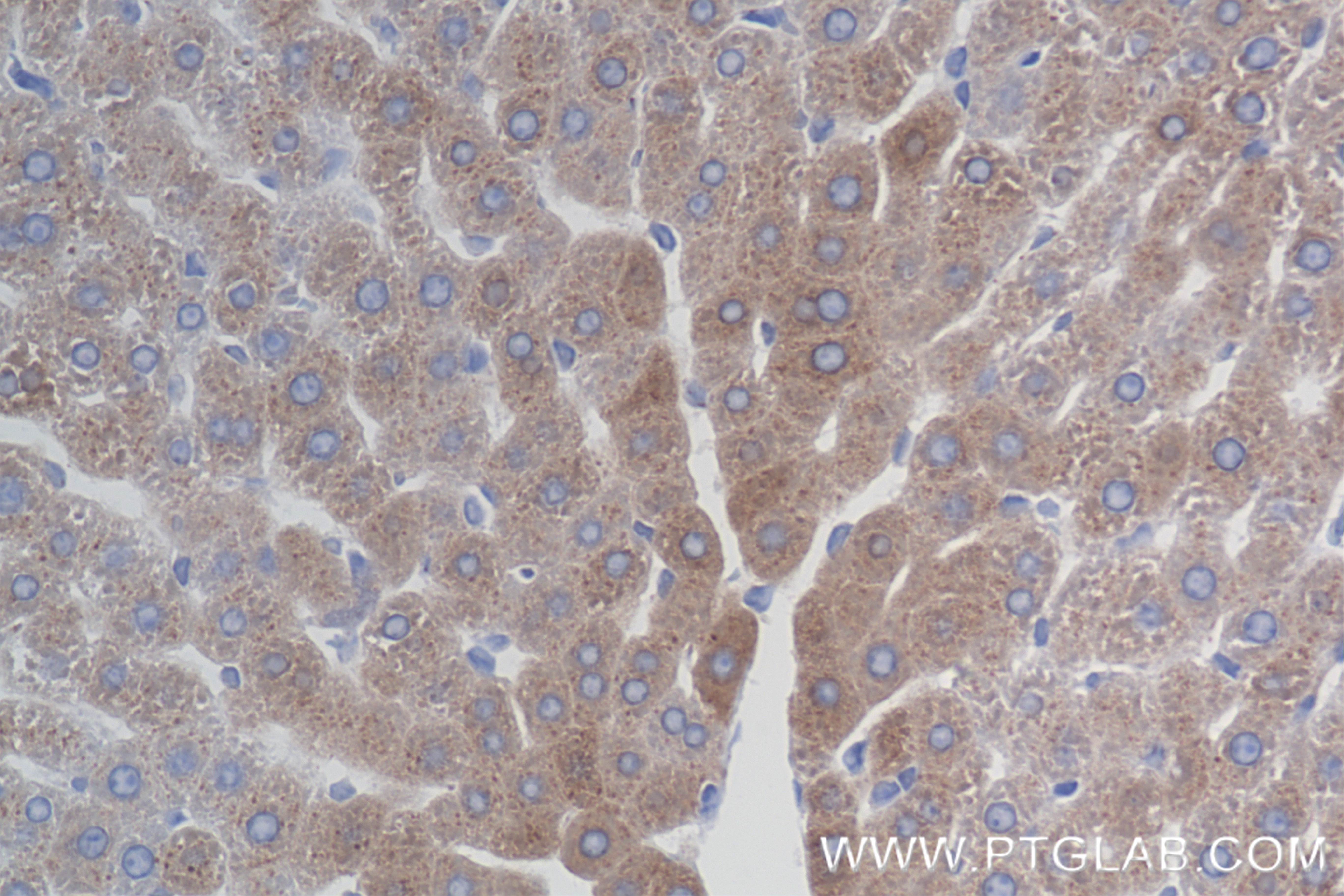 IHC staining of rat liver using 84782-5-RR (same clone as 84782-5-PBS)