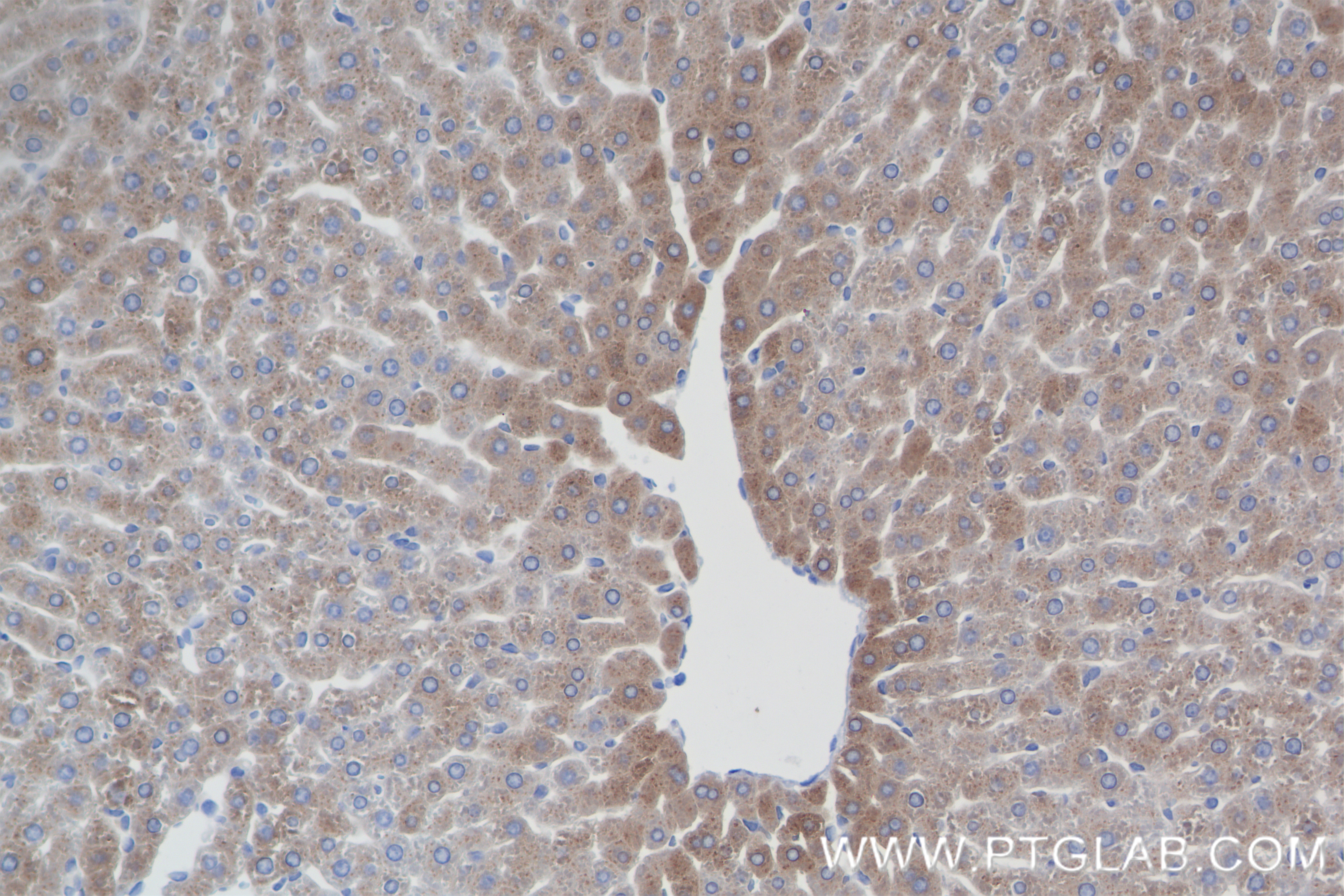 IHC staining of rat liver using 84782-5-RR (same clone as 84782-5-PBS)
