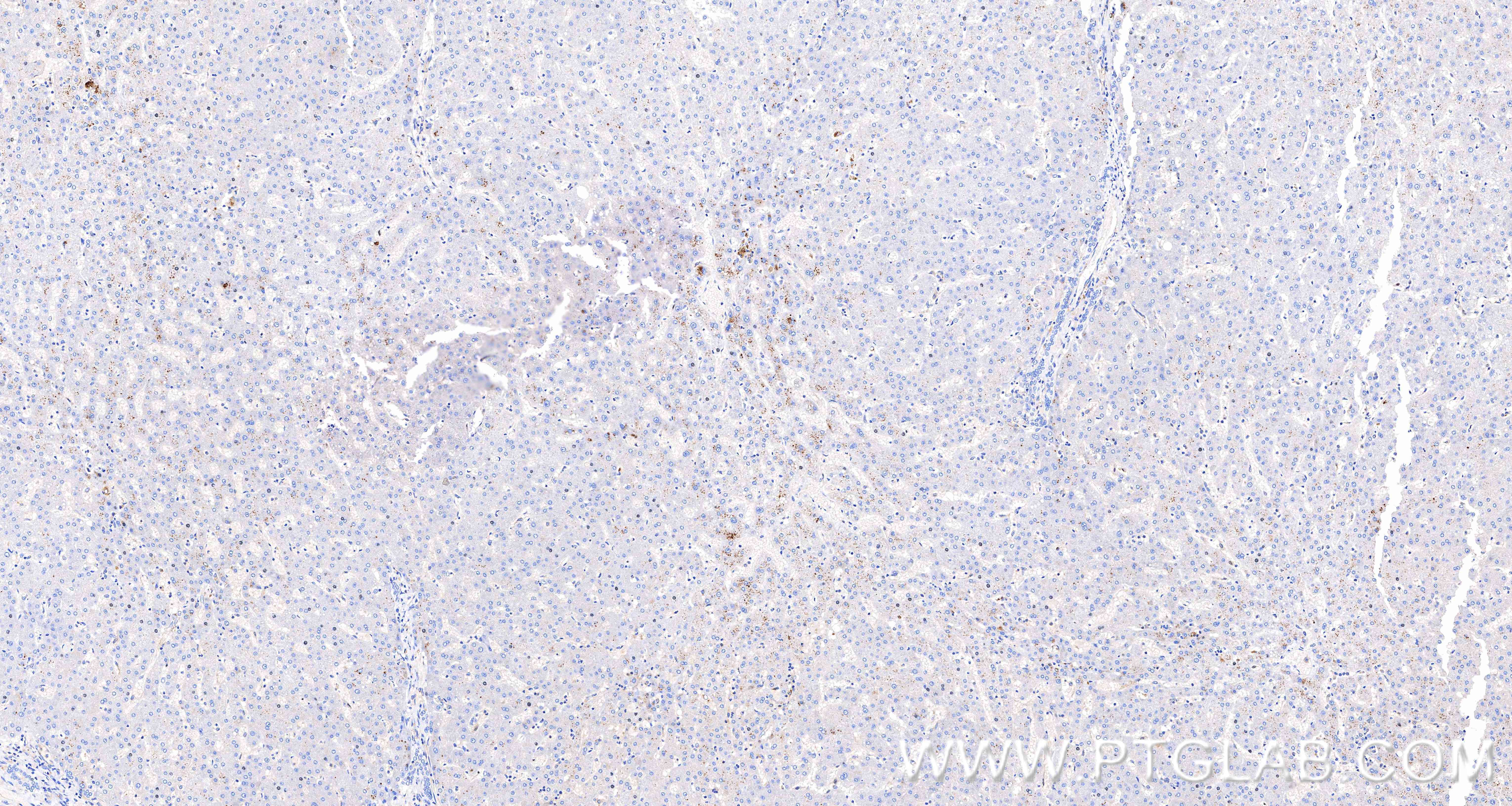 IHC staining of human liver using 98889-3-RR IHC staining of human liver using 98889-3-RR