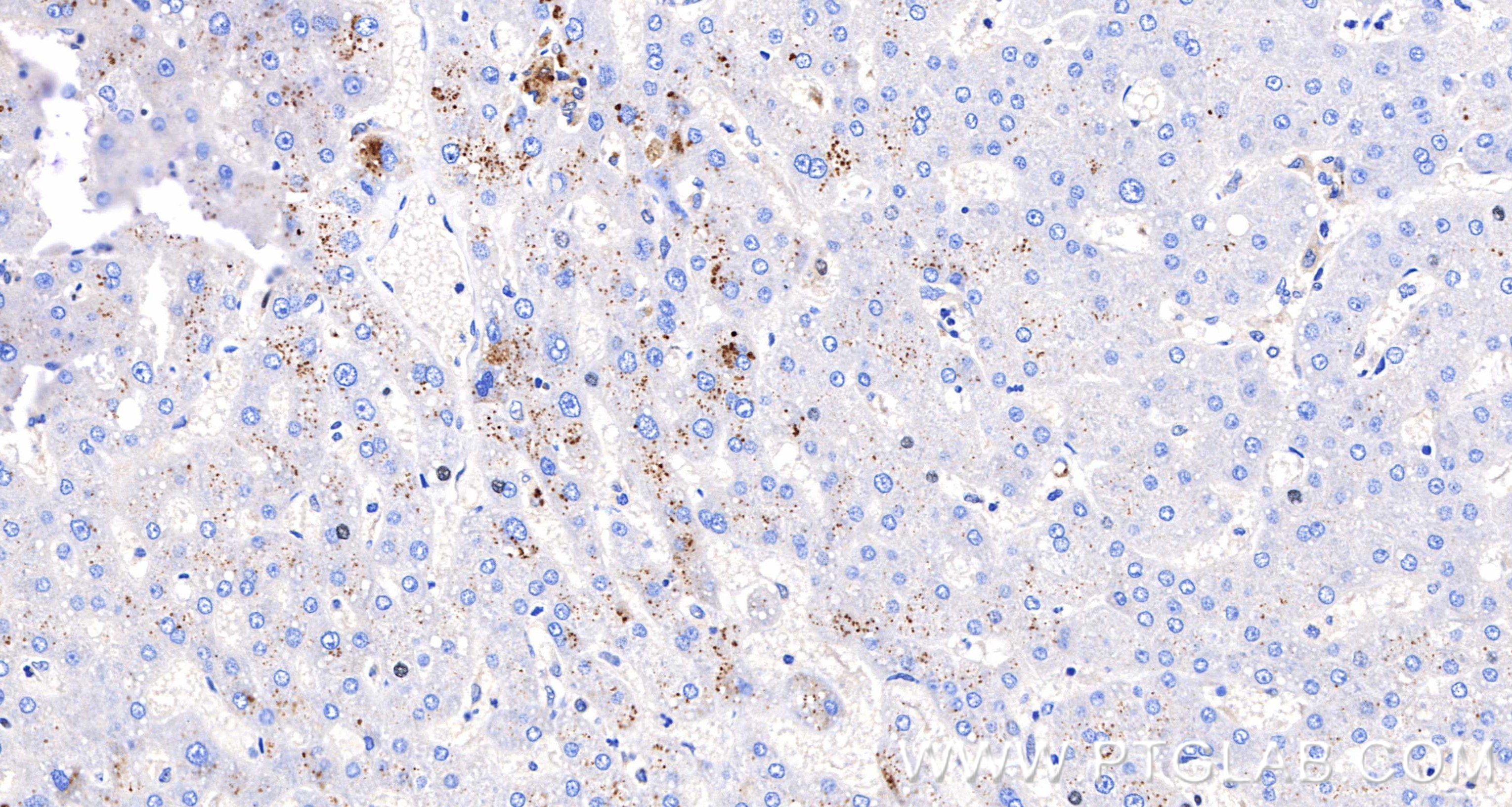 IHC staining of human liver using 98889-3-RR IHC staining of human liver using 98889-3-RR