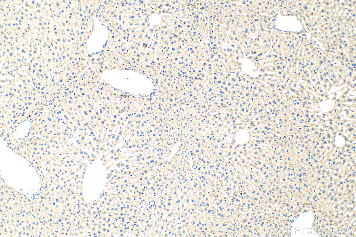 IHC staining of mouse liver using 20214-1-AP
