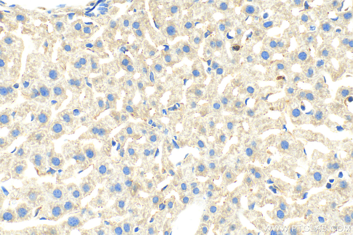 IHC staining of mouse liver using 20214-1-AP