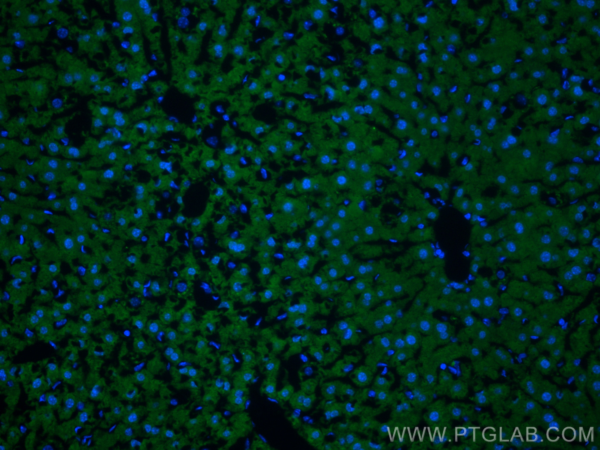 IF Staining of mouse liver using 20215-1-AP