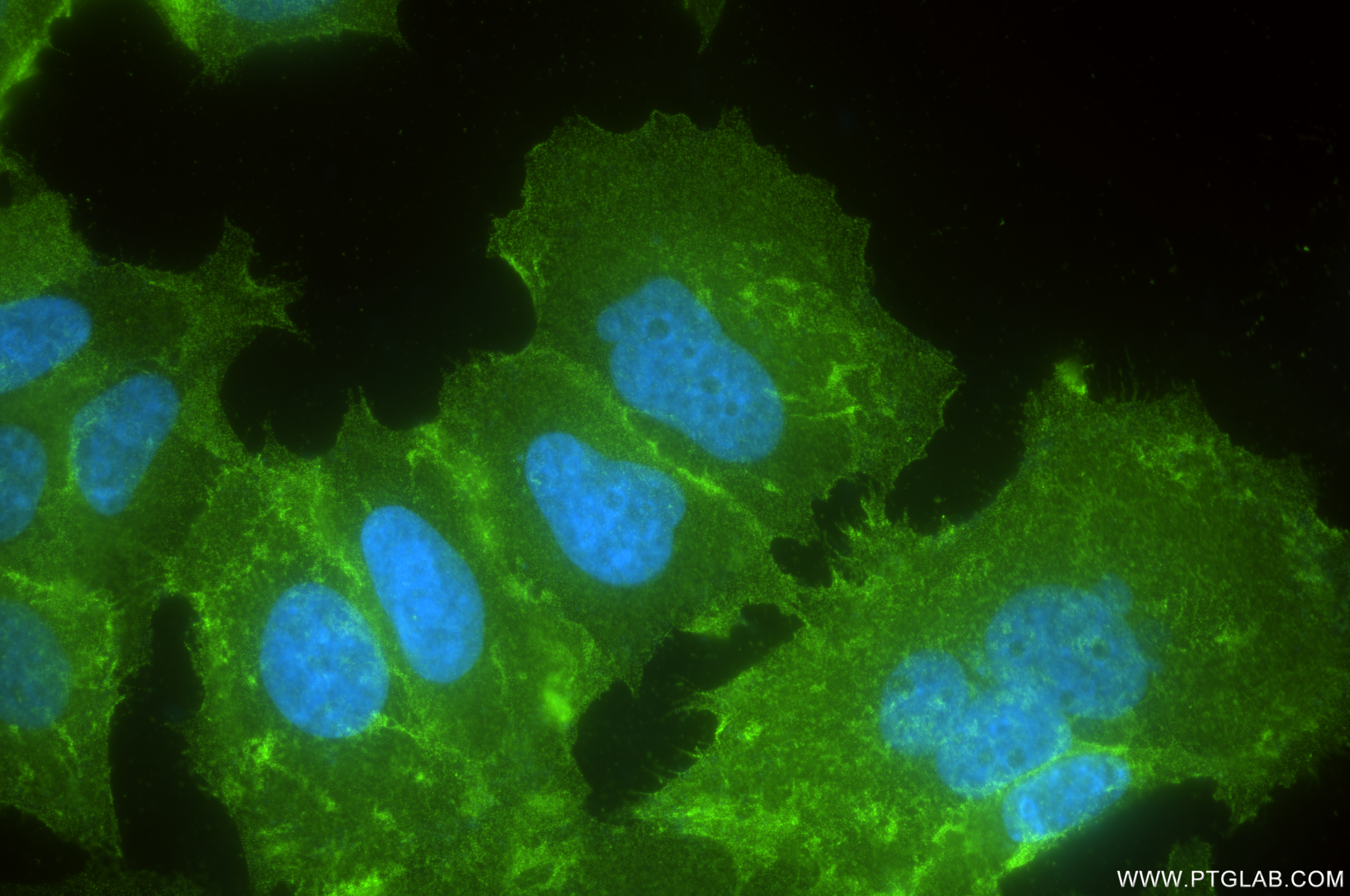 IF Staining of MCF-7 using 84385-3-RR (same clone as 84385-3-PBS)