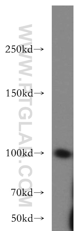 WB analysis of HeLa using 20254-1-AP