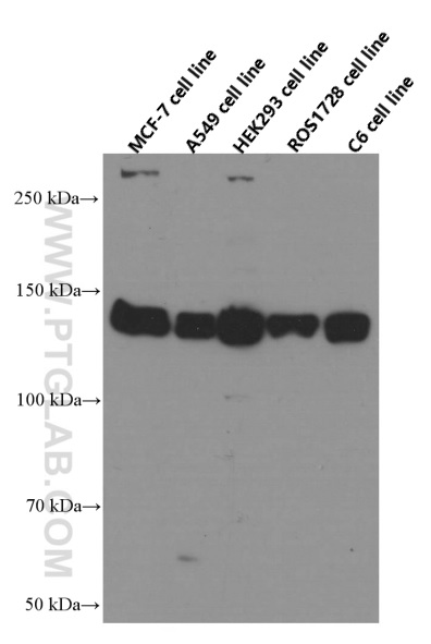 IGF1R Monoclonal antibody