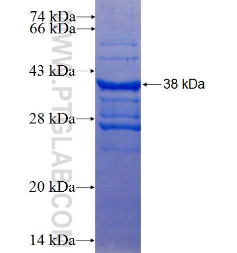 IGF2 fusion protein Ag25933 SDS-PAGE IGF2 fusion protein Ag25933 SDS-PAGE