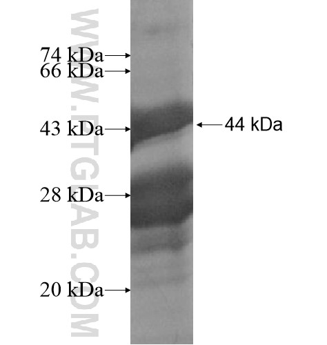 IGF2AS fusion protein Ag15528 SDS-PAGE IGF2AS fusion protein Ag15528 SDS-PAGE
