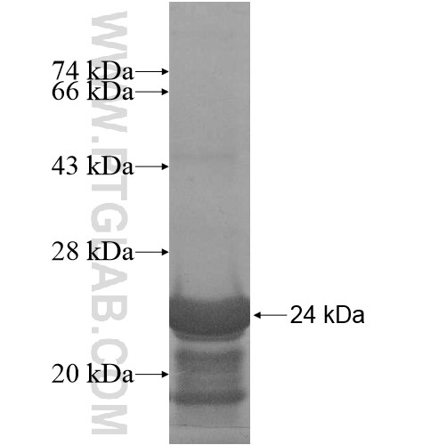 IGF2AS fusion protein Ag15852 SDS-PAGE IGF2AS fusion protein Ag15852 SDS-PAGE
