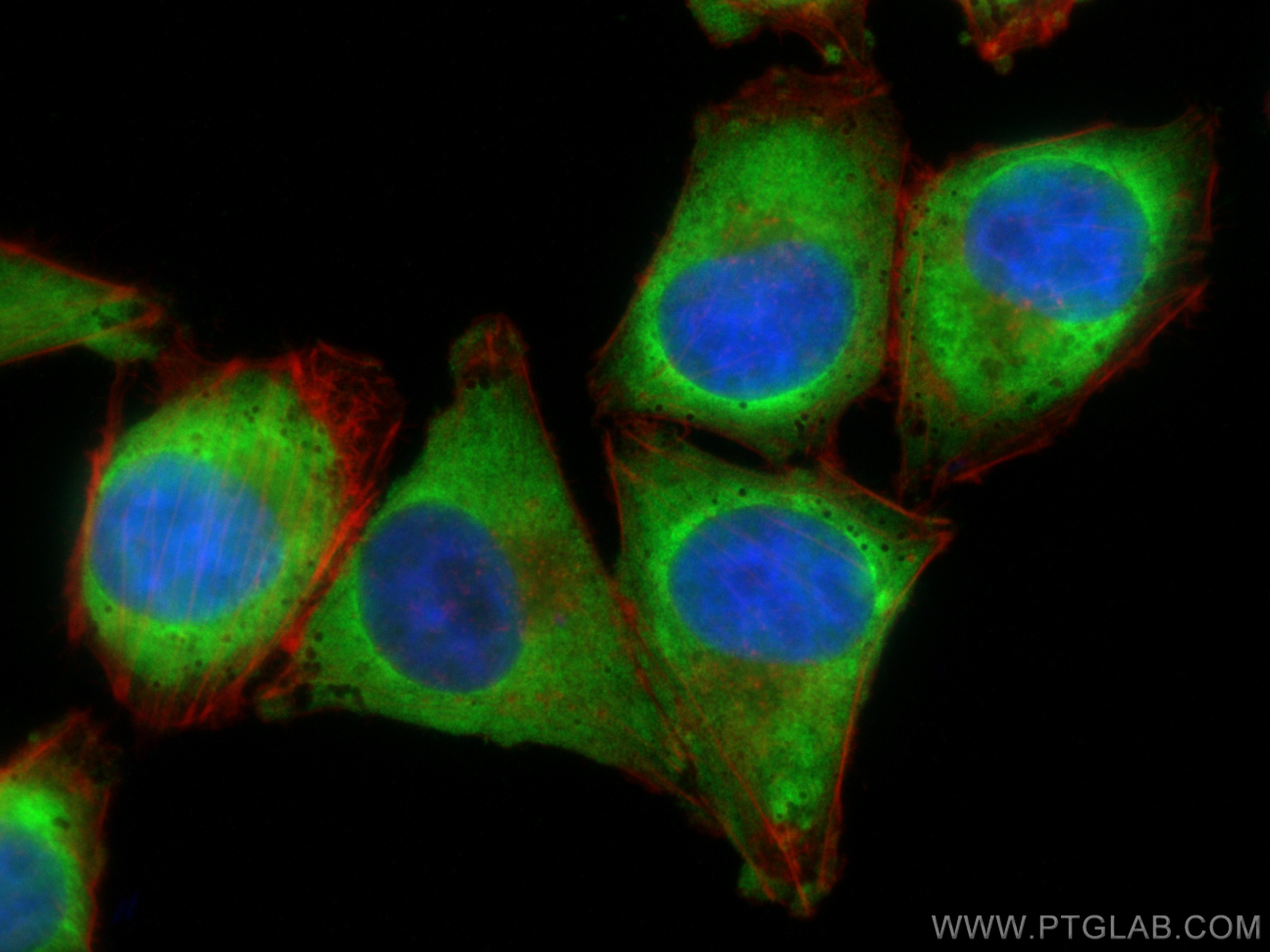 IF Staining of A375 using 22803-1-AP