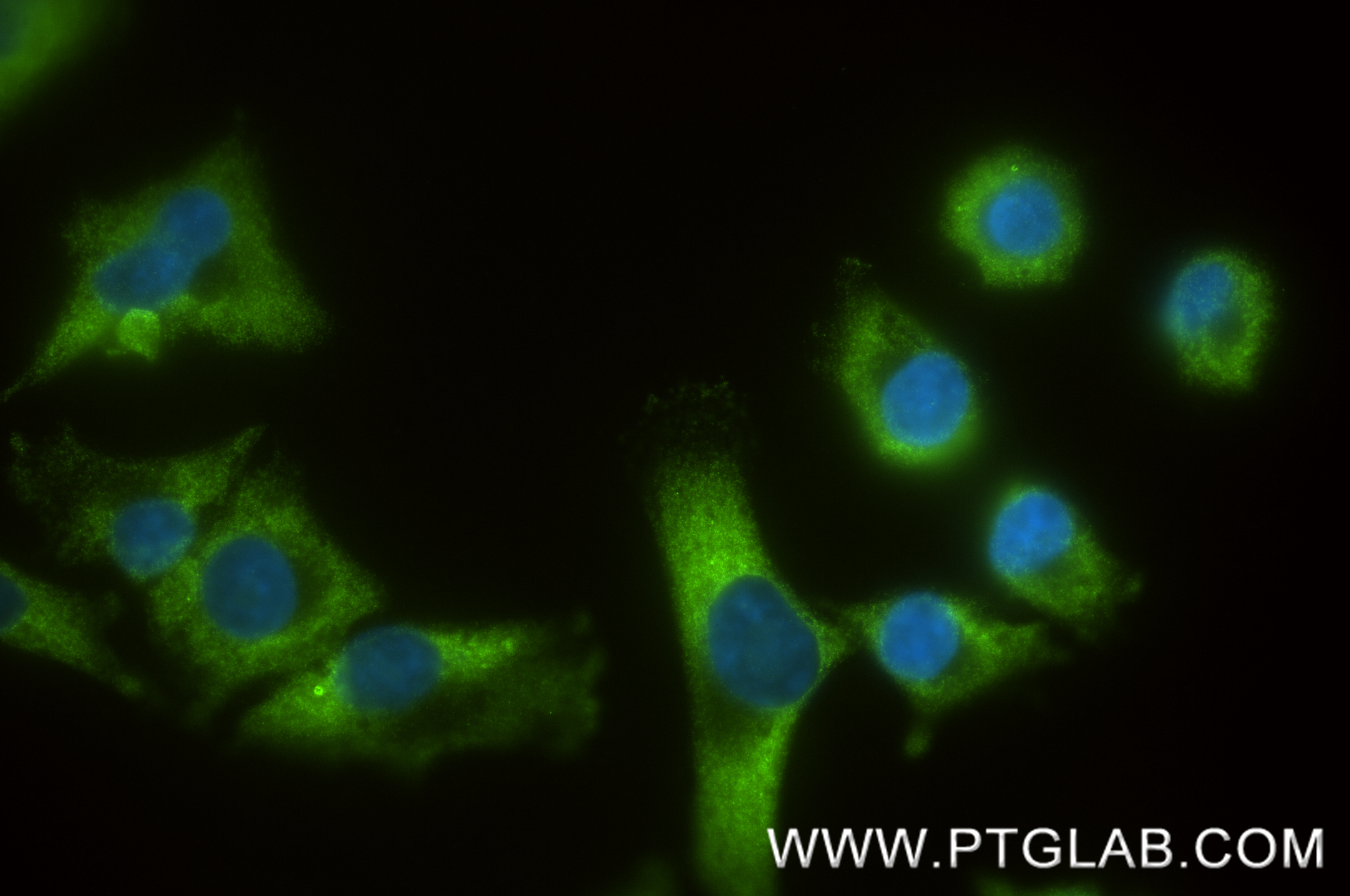 IF Staining of A375 using 88123-1-RR (same clone as 88123-1-PBS) IF Staining of A375 using 88123-1-RR (same clone as 88123-1-PBS)