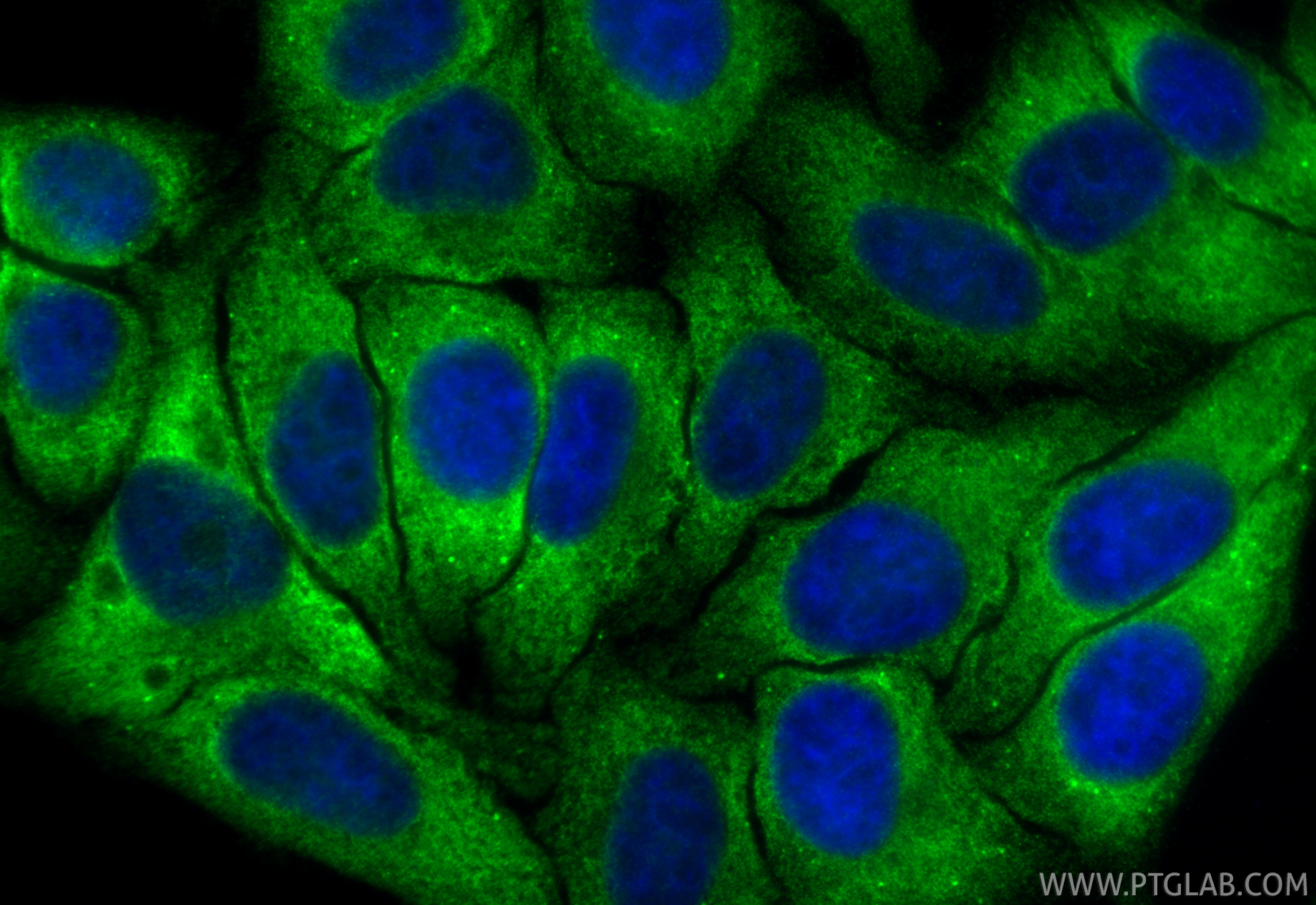 IF Staining of HepG2 using 11601-1-AP