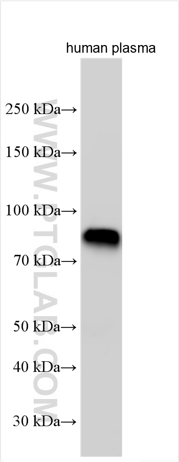WB analysis of human plasma using 24545-1-AP