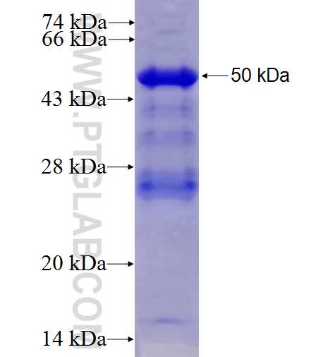IGFBP1 fusion protein Ag5026 SDS-PAGE