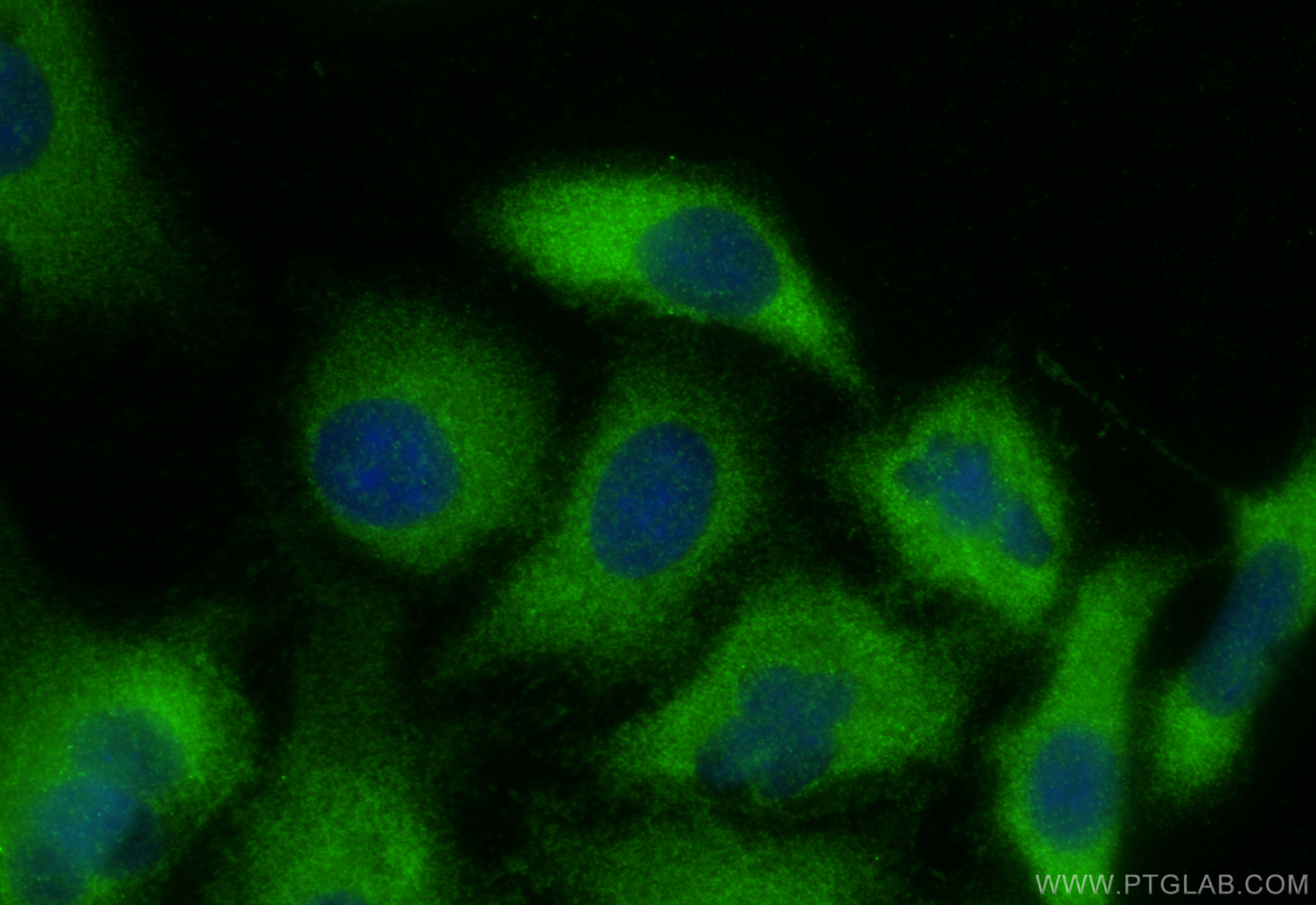 IF Staining of A549 using 15699-1-AP
