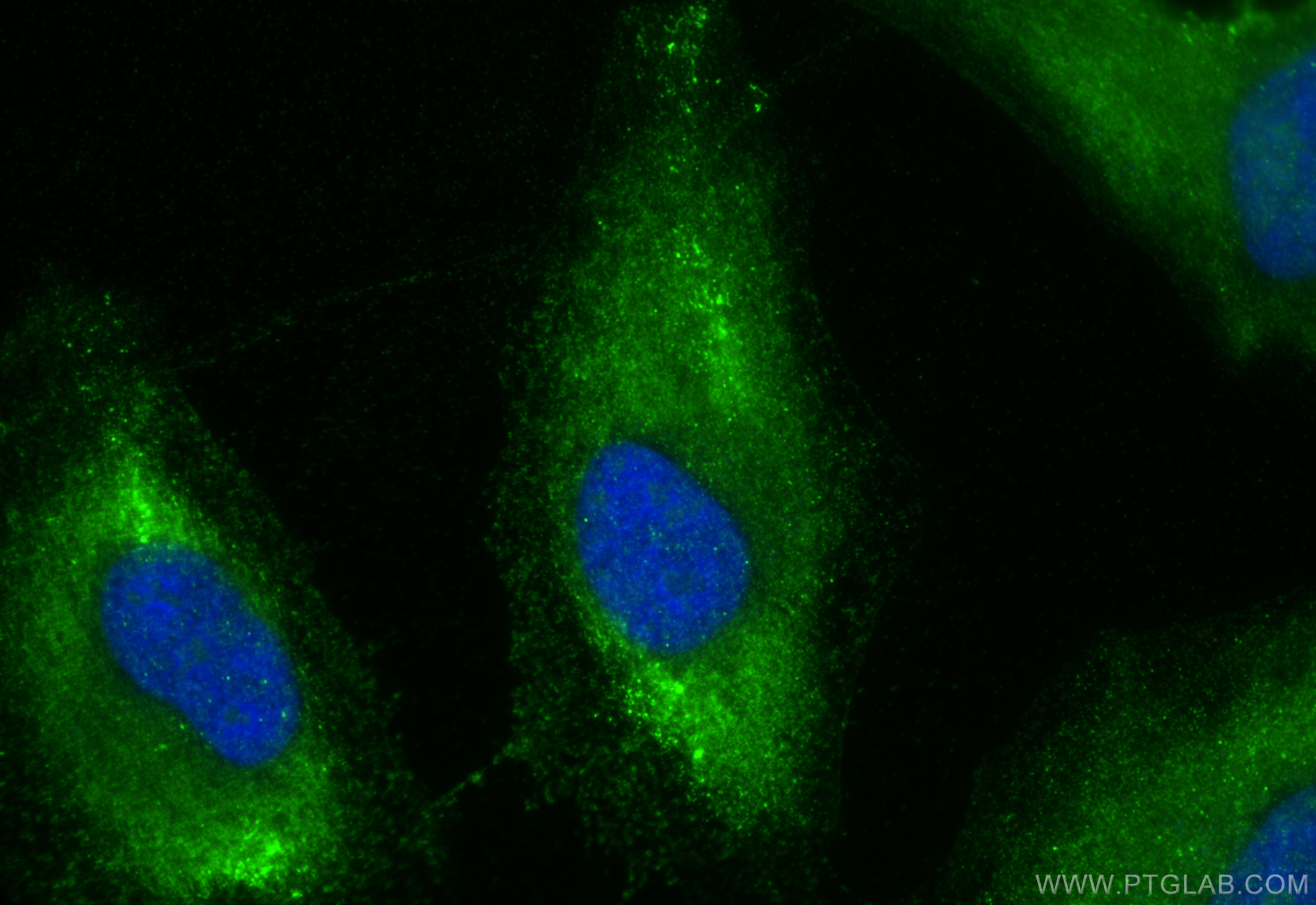 IF Staining of HeLa using 15699-1-AP