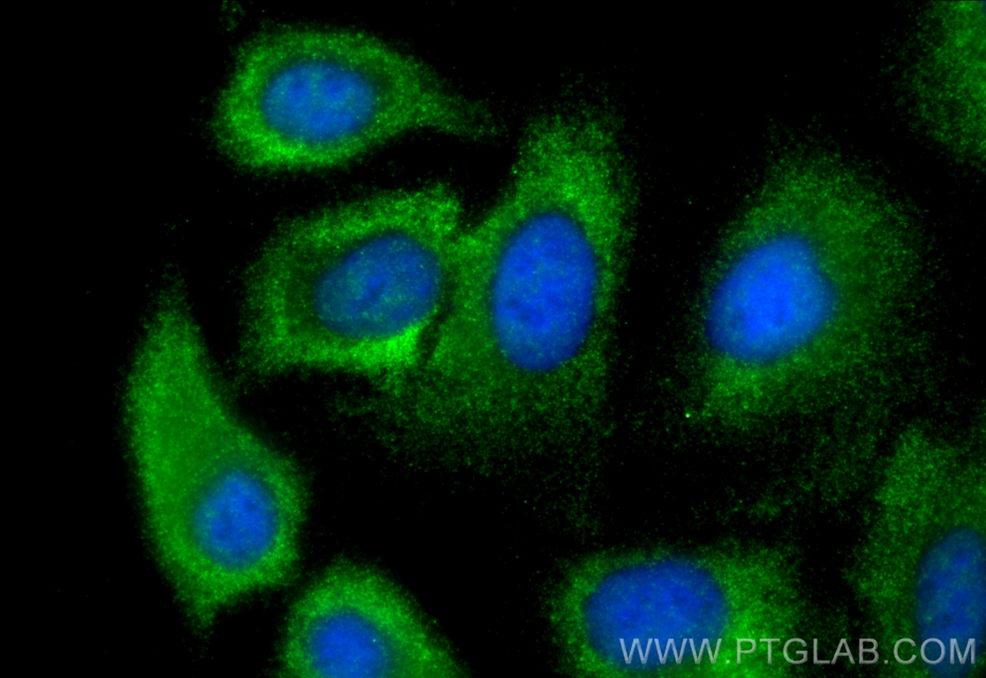 IF Staining of A549 using 66644-1-Ig (same clone as 66644-1-PBS)