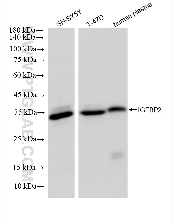 WB analysis using 83283-3-RR (same clone as 83283-3-PBS)