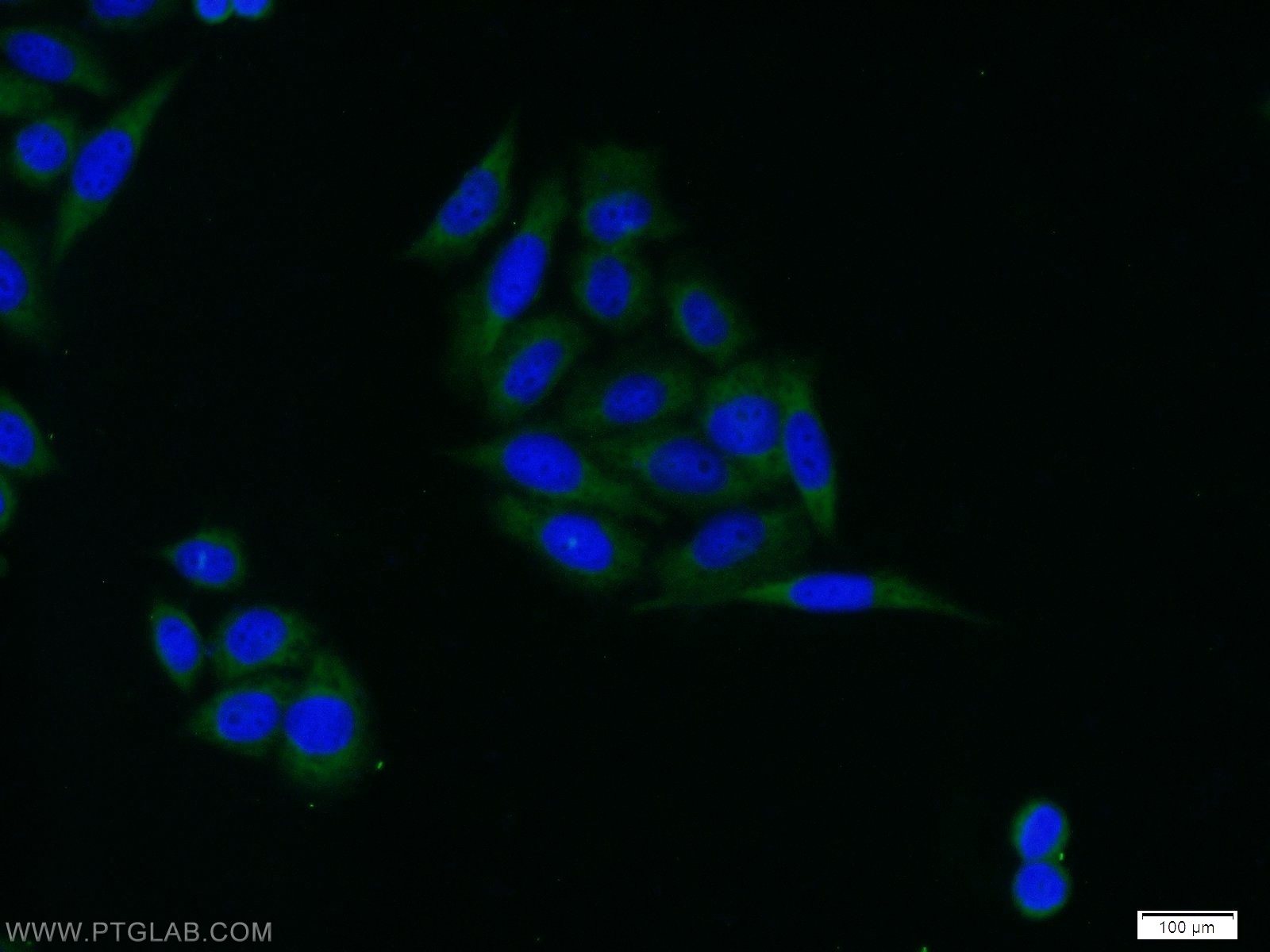 IF Staining of HeLa using 10189-2-AP
