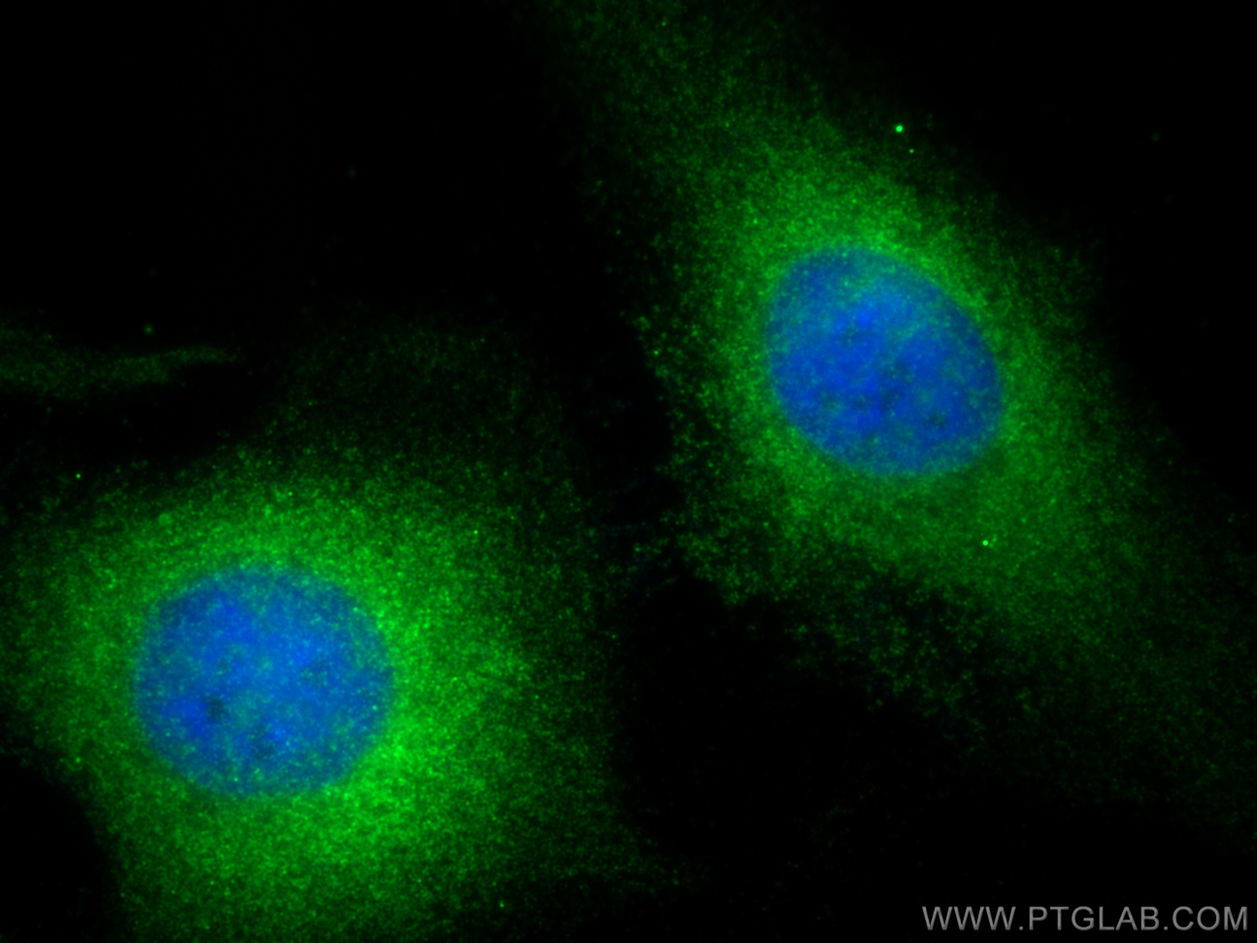 IF Staining of HeLa using 10189-2-AP