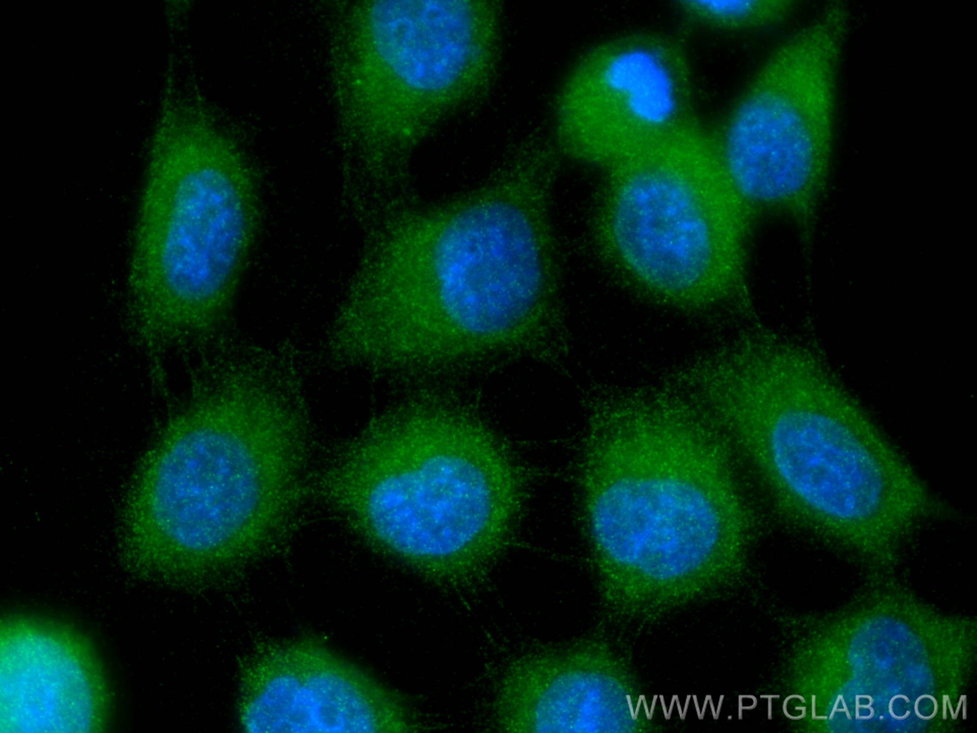 IF Staining of A431 using 30593-1-AP