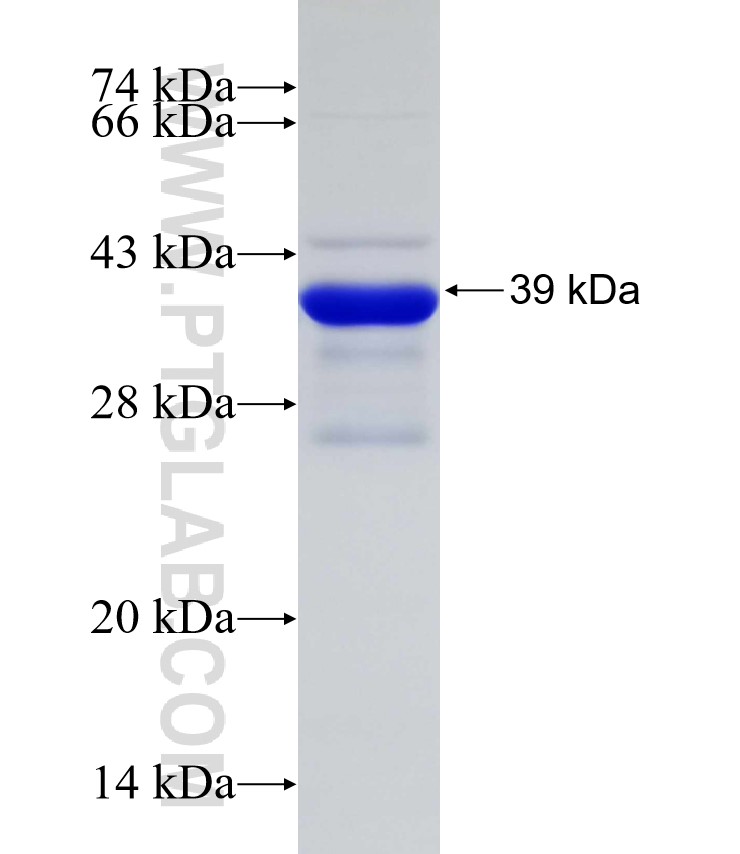 IGFBP3 fusion protein Ag31285 SDS-PAGE