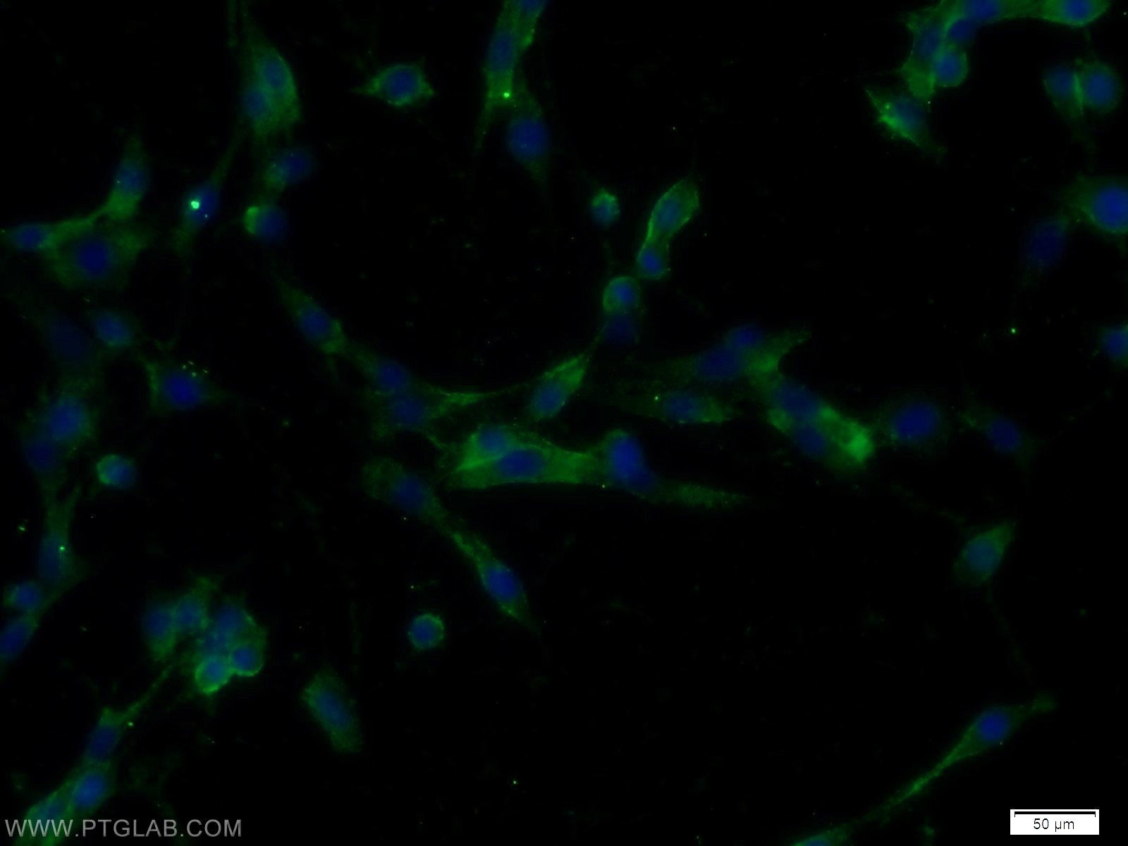 IF Staining of C6 using 18500-1-AP