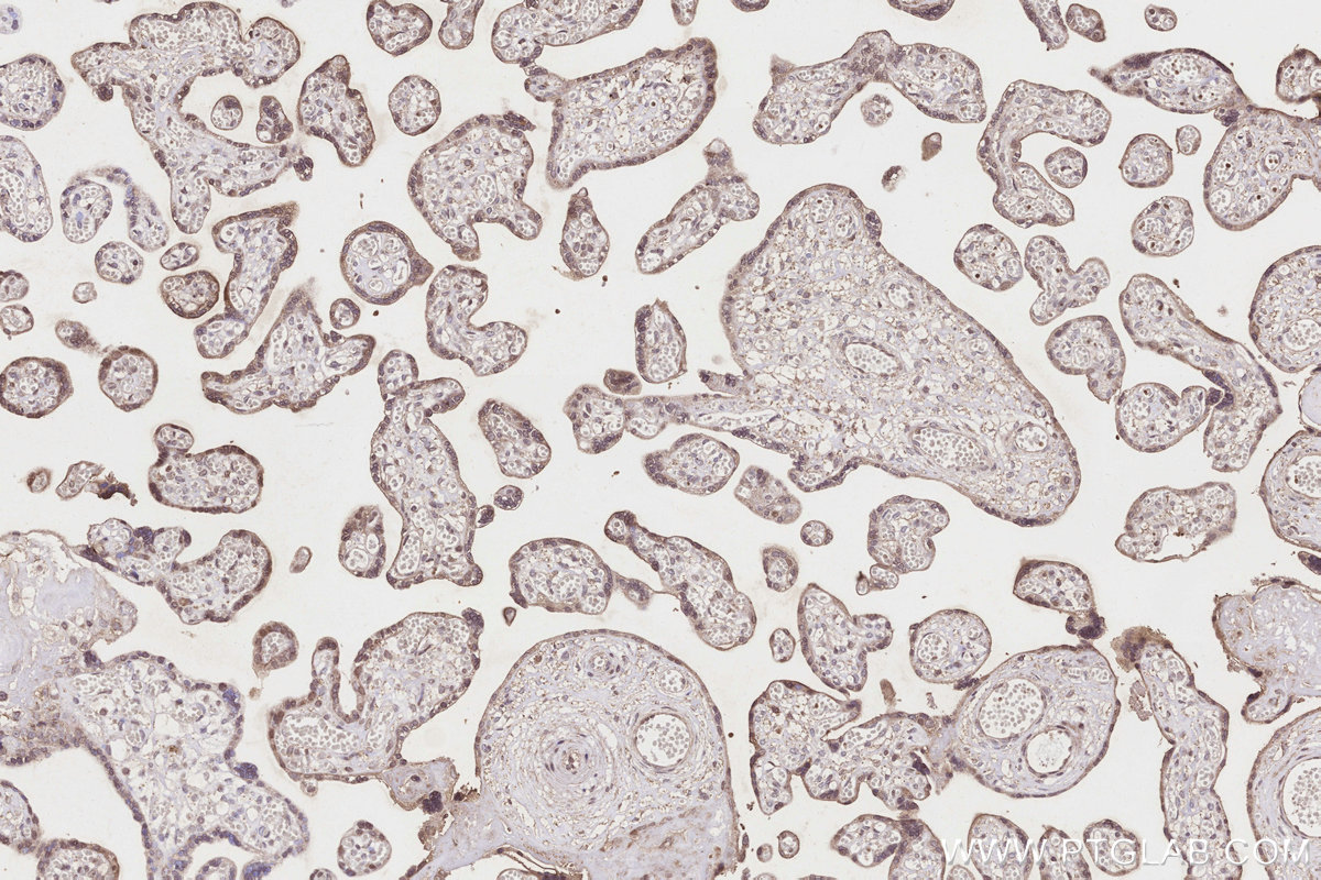 IHC staining of human placenta using 55205-1-AP