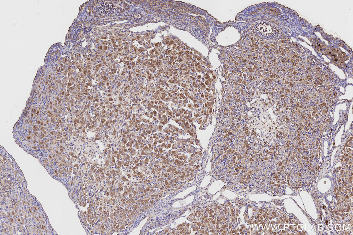 IHC staining of rat ovary using 55205-1-AP