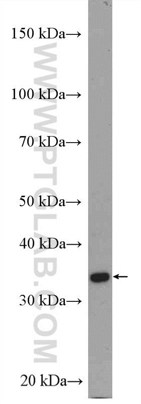 WB analysis of SKOV-3 using 55205-1-AP