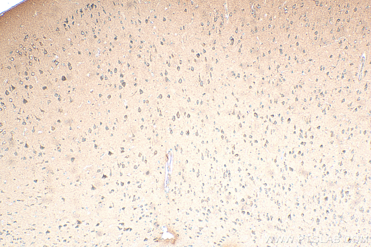 IHC staining of mouse brain using 68512-1-Ig