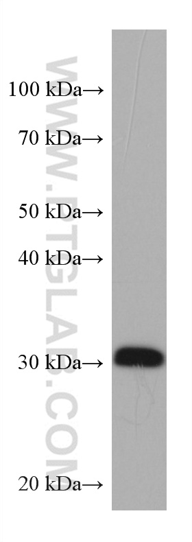 WB analysis of U-87 MG using 67567-1-Ig