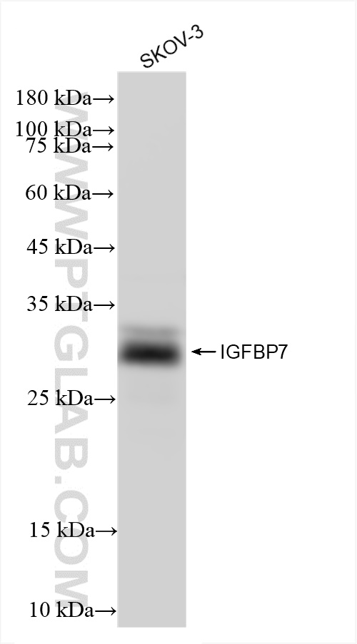 WB analysis of SKOV-3 using 83292-5-RR (same clone as 83292-5-PBS)